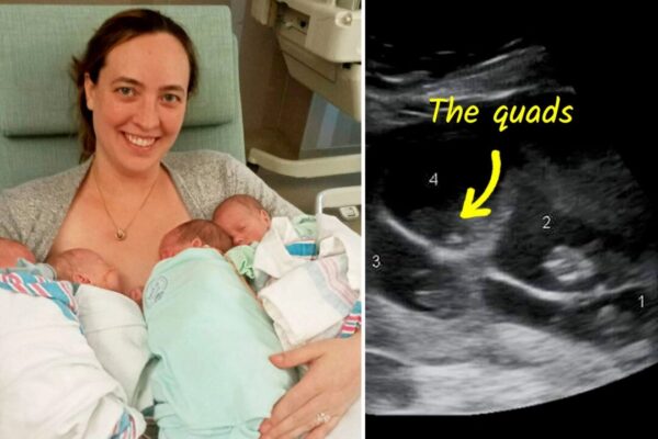 4人の子供を失った母親が一卵性四つ子を出産「まるで運命のようだ」