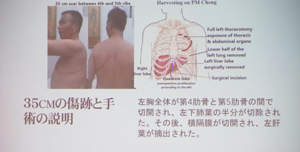 証言が明かす弾圧の現実　法輪功学習者たちの声　東京で響く